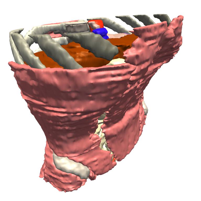 SPL Abdominal Atlas