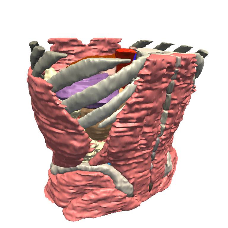 SPL Abdominal Atlas