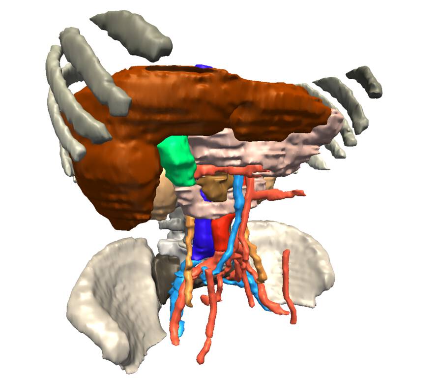 SPL Abdominal Atlas