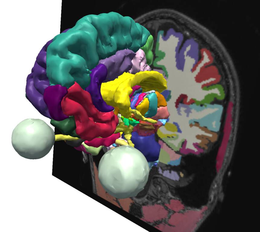 SPL/NAC Brain Atlas