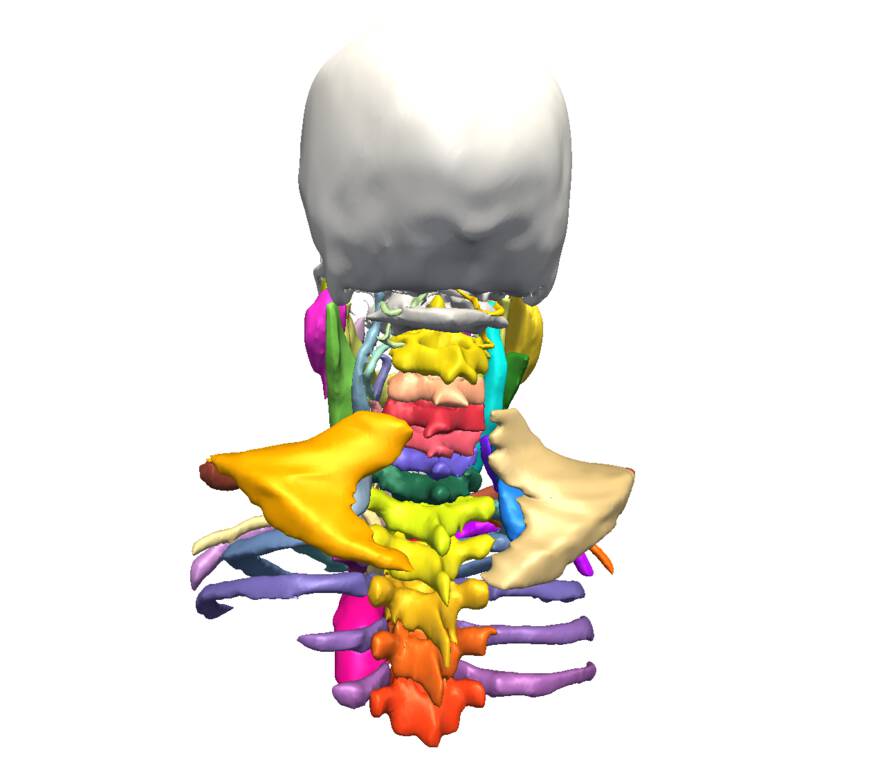 SPL Head and Neck Atlas