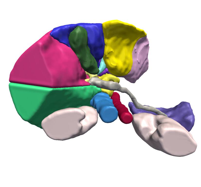 SPL Liver Atlas