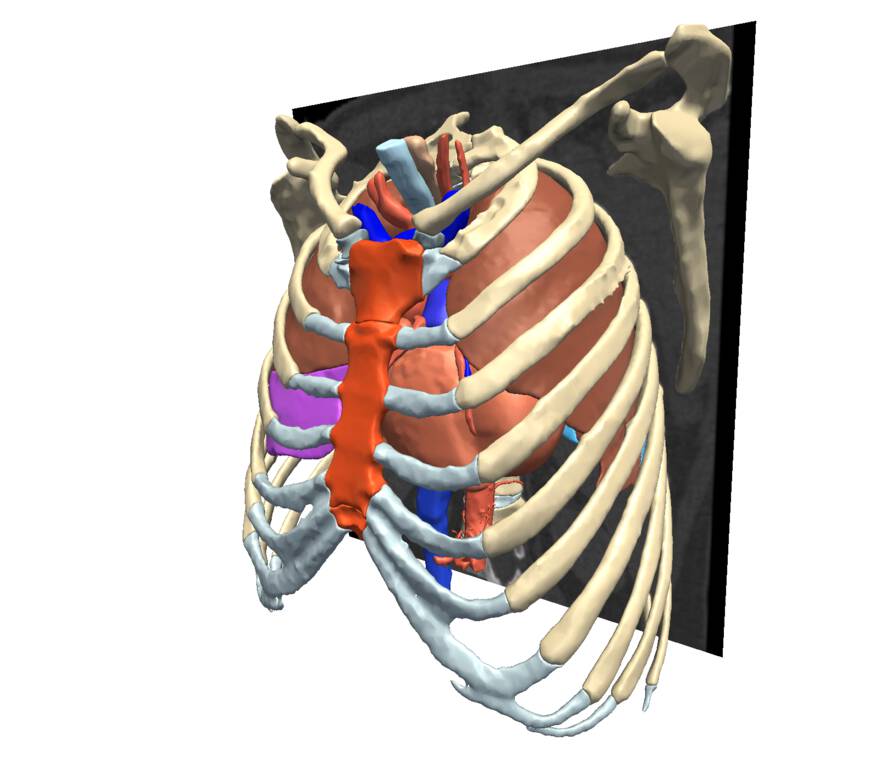 Mauritanian Anatomy Laboratory Thoracic Atlas