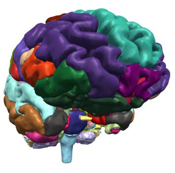 right hemisphere of brain