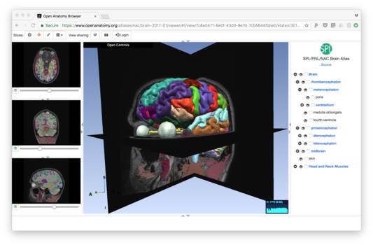 Open Anatomy Browser view of brain